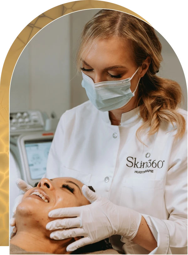 Acne Skin360 Huidkliniek