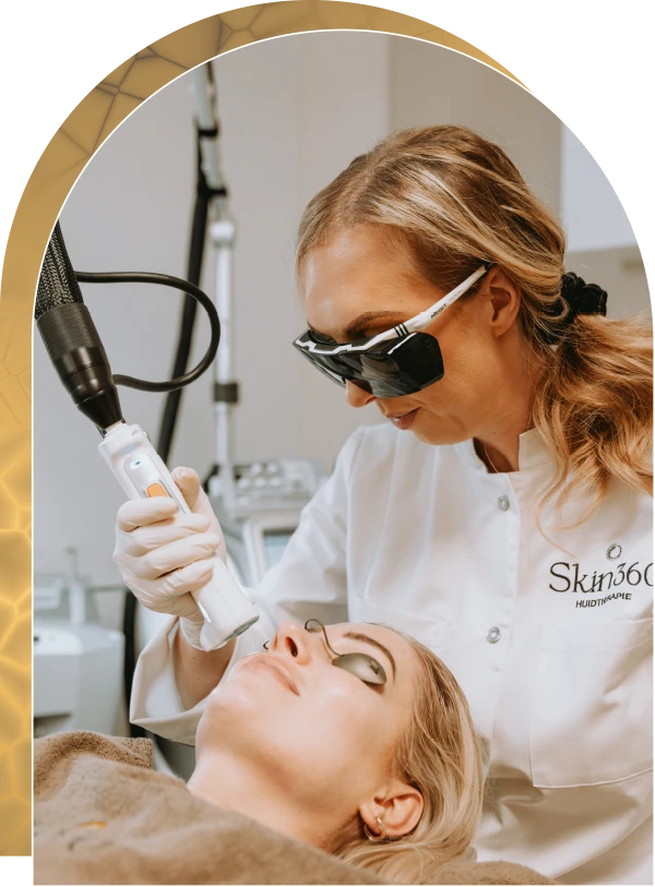 Huidbultjes Skin360 Huidkliniek
