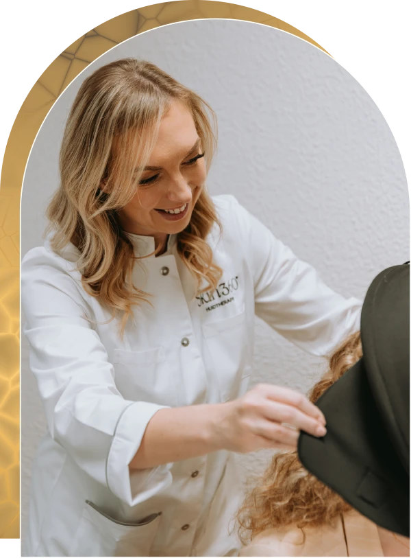 Melasma Skin360 Huidkliniek